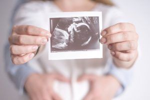 A pregnant woman is holding a picture of her baby in her hands.