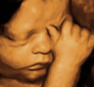 A close up of a baby 's face with its hands on its face.
