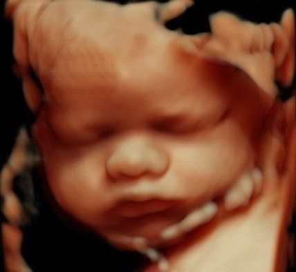 A close up of a baby 's face with a black background