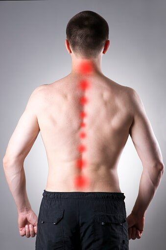 A man showing a spine pain illustration — Jersey City, NJ — Pain and Disability Institute