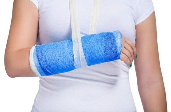 A woman with an injured arm — Jersey City, NJ — Pain and Disability Institute