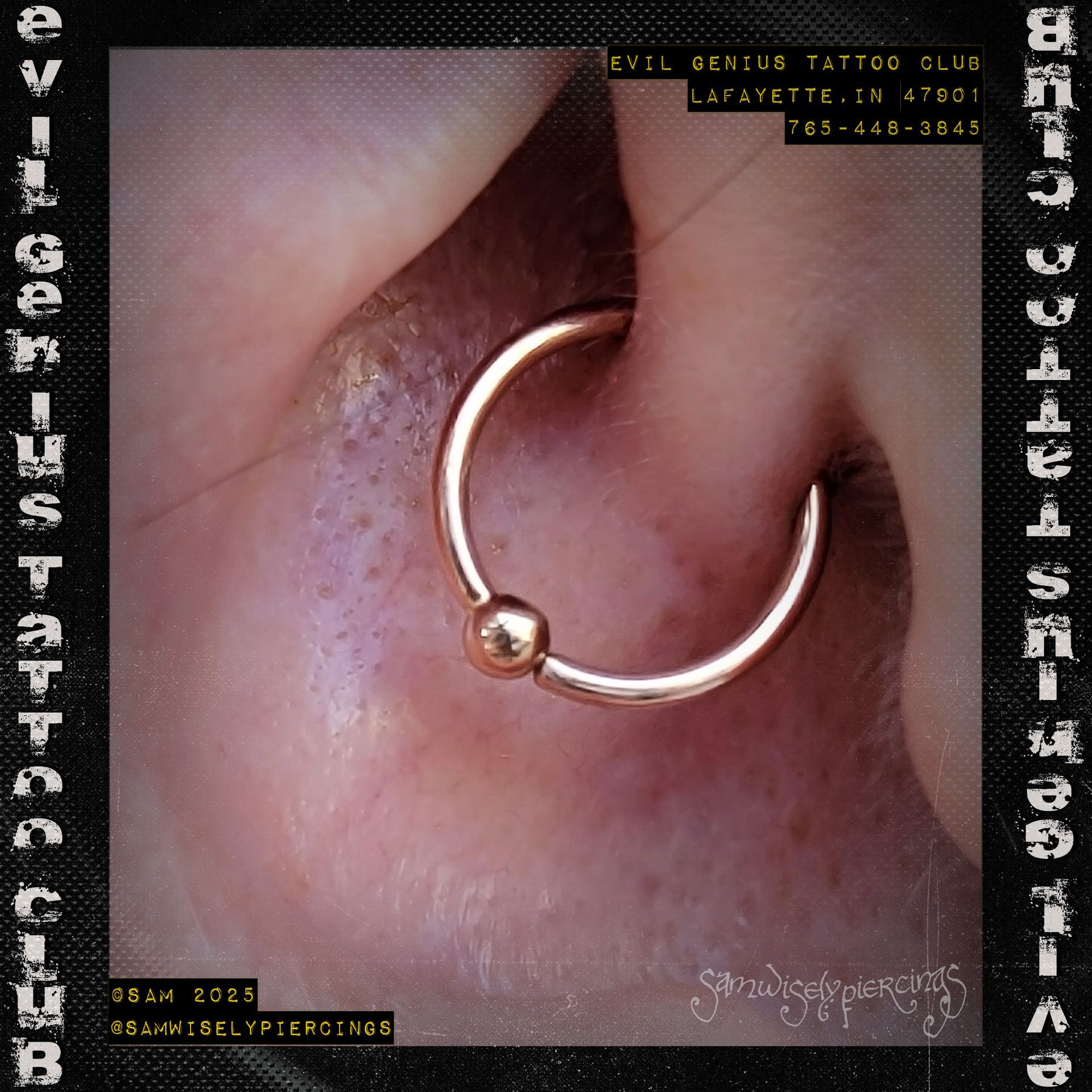 Close-up of ear with fresh daith piercing performed by Sam.