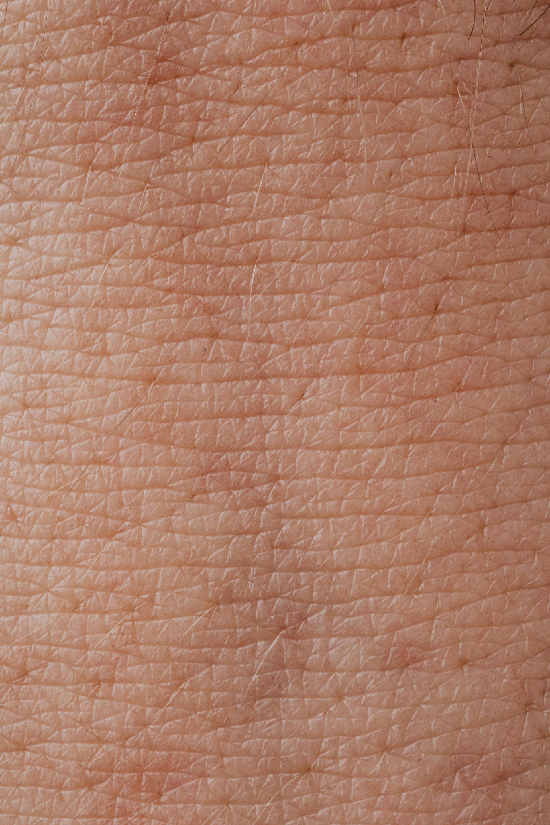A close up of a person 's skin showing the texture of the skin.