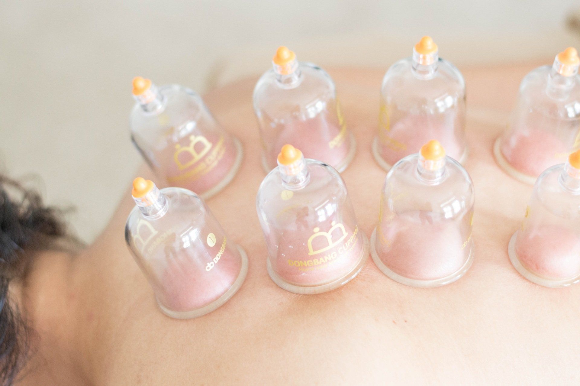 cupping massage cups therapeutisch