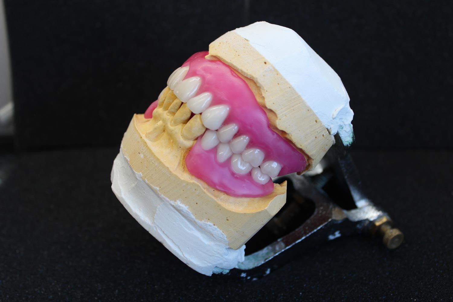 Dentures In Progress