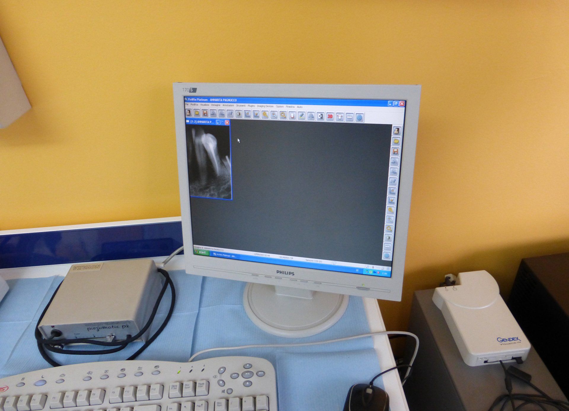 Strumenti moderni per la radiologia odontoiatrica