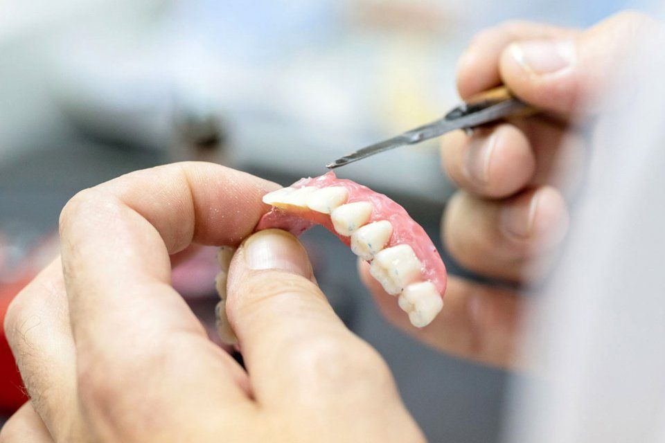 Una protesi dentale mobile