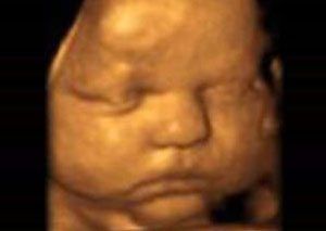3d 4d Ultrasound Pictures Women S Health Services Of Md Gender Ultrasound In Baltimore Md 410 768 0262
