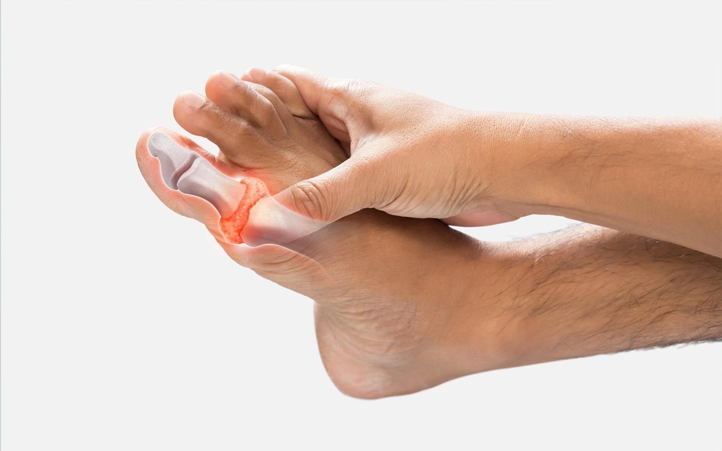 Person holding foot, with red highlighting on big toe indicating pain; skeletal structure shown.