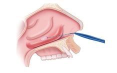 chirurgia funzionale