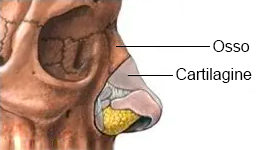 chirurgia naso sinusale