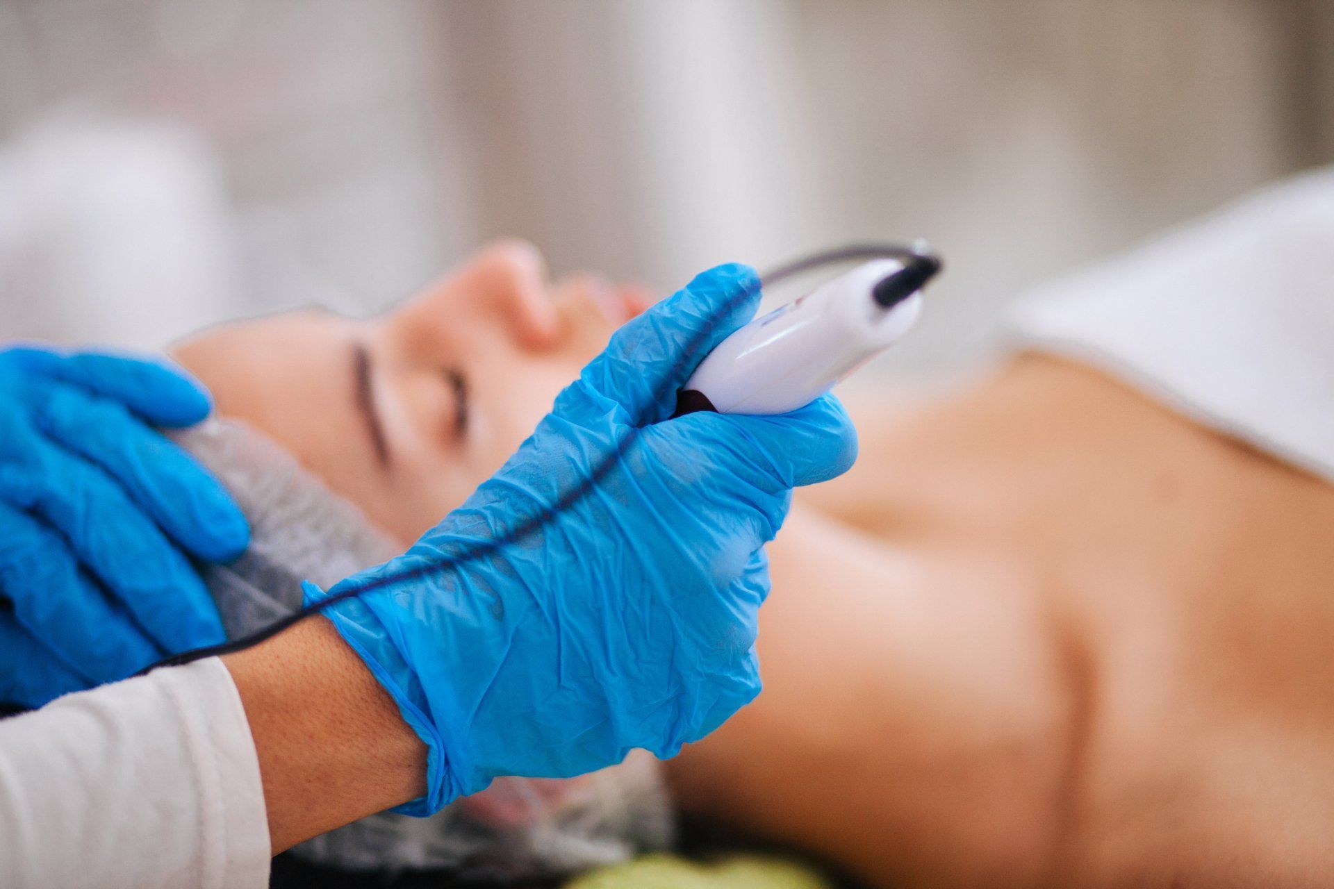 hair removal using laser