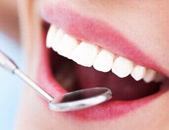 White Teeth — Oral Hygiene in Naples, FL
