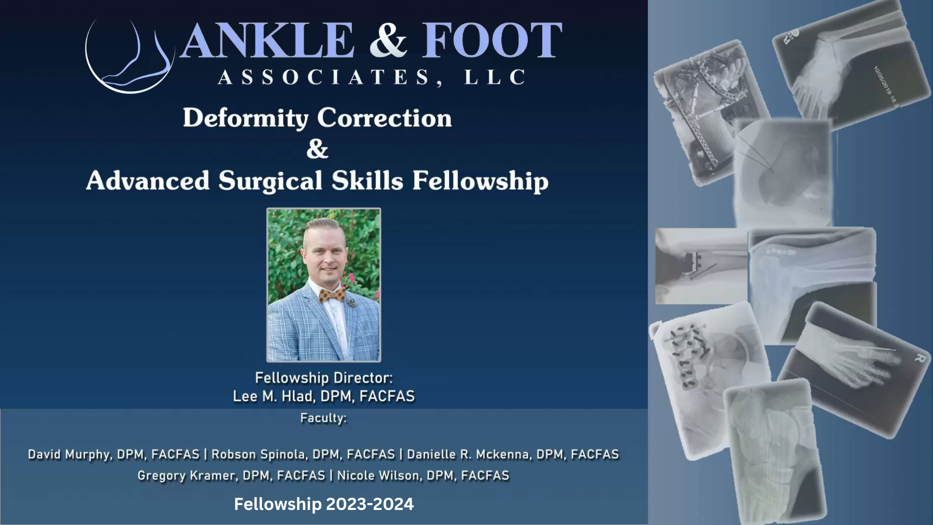 Ankle & Foot Associates deformity correction and advanced surgical skills fellowship - fellowship director Lee Hlad, DPM, FACFAS