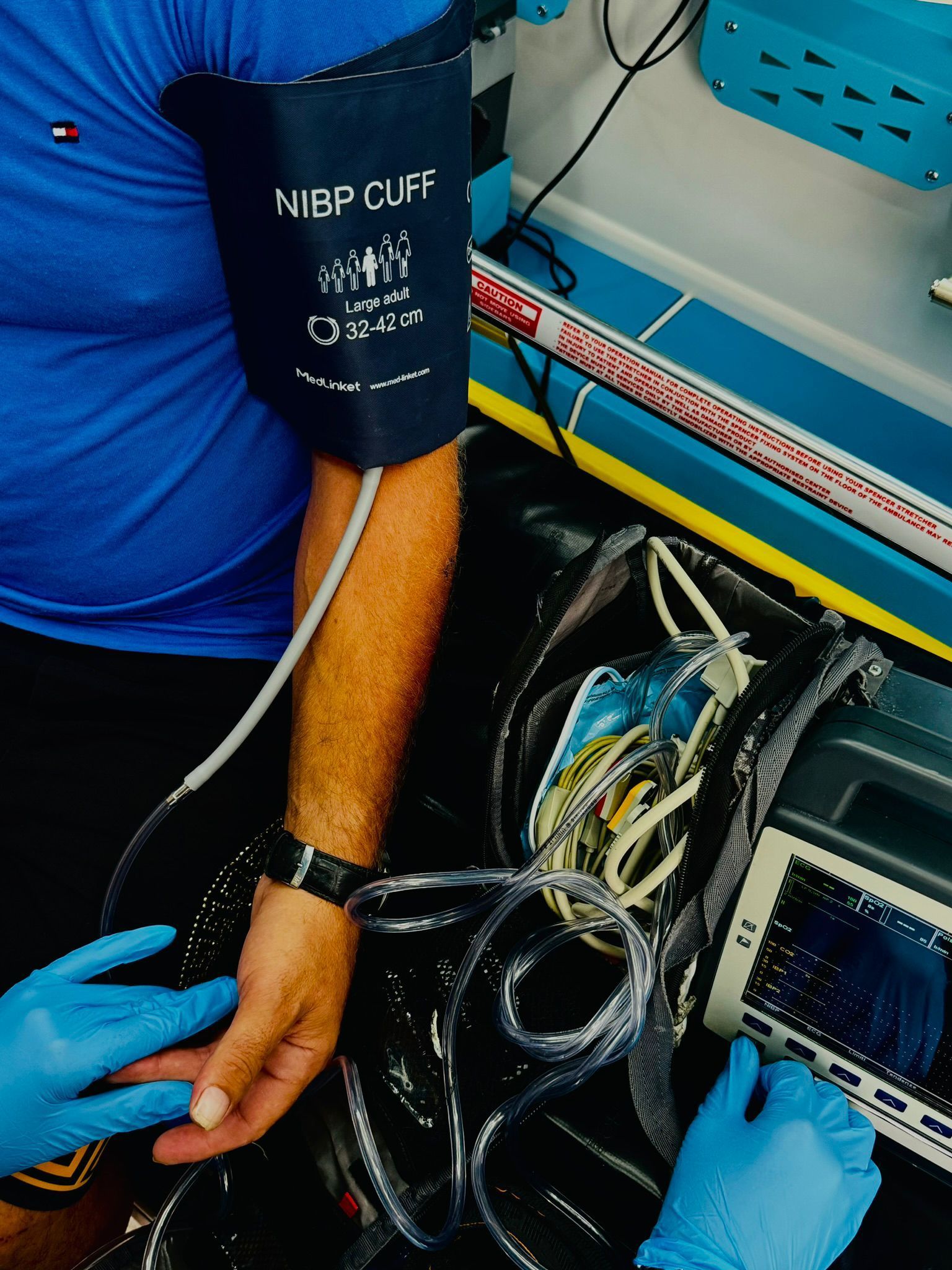 Il braccio di una persona con il misuratore di pressione sanguigna e l'apparecchiatura di monitoraggio; un operatore sanitario con i guanti blu.