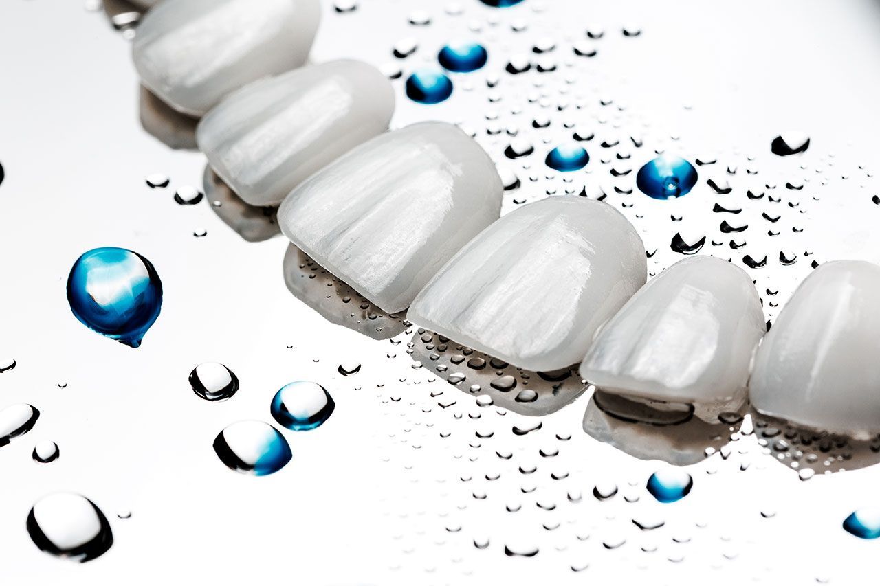 Veneers Dentist Near Me