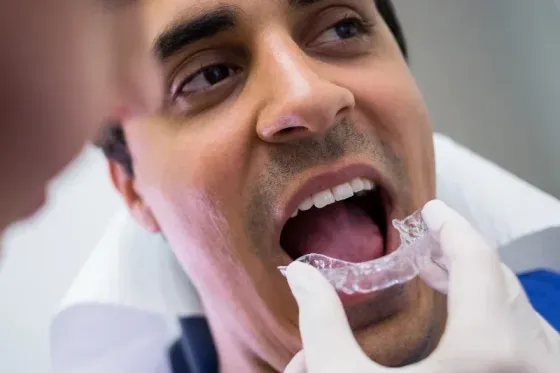 A 3d rendering of a dental implant in a person 's mouth.