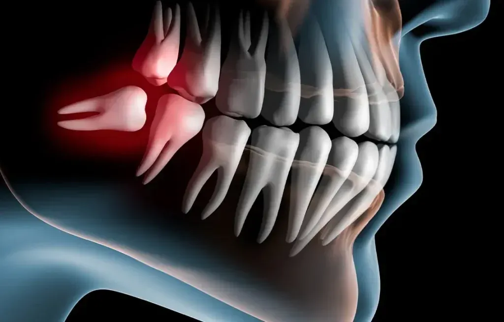 A close up of a person 's teeth with a red spot on one of them.