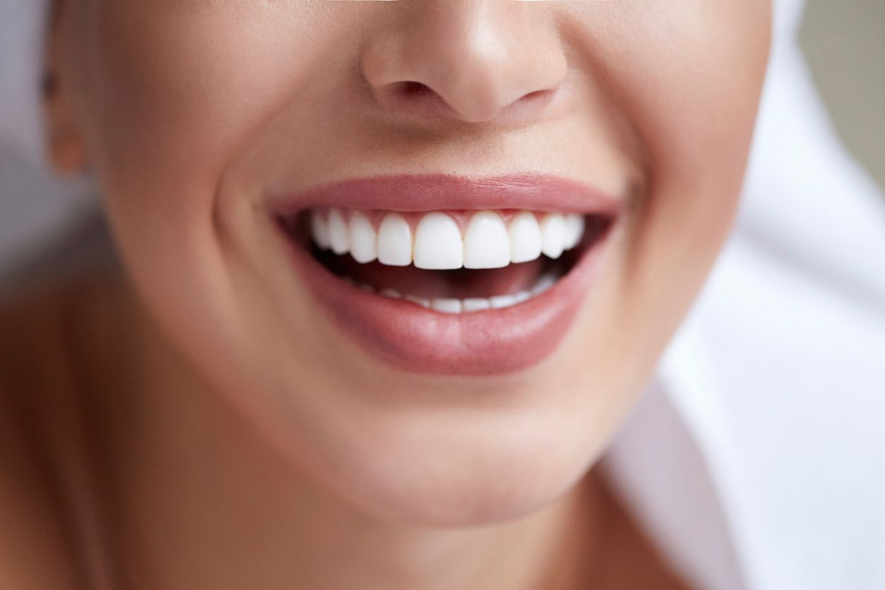 A woman is putting a clear brace on her teeth.