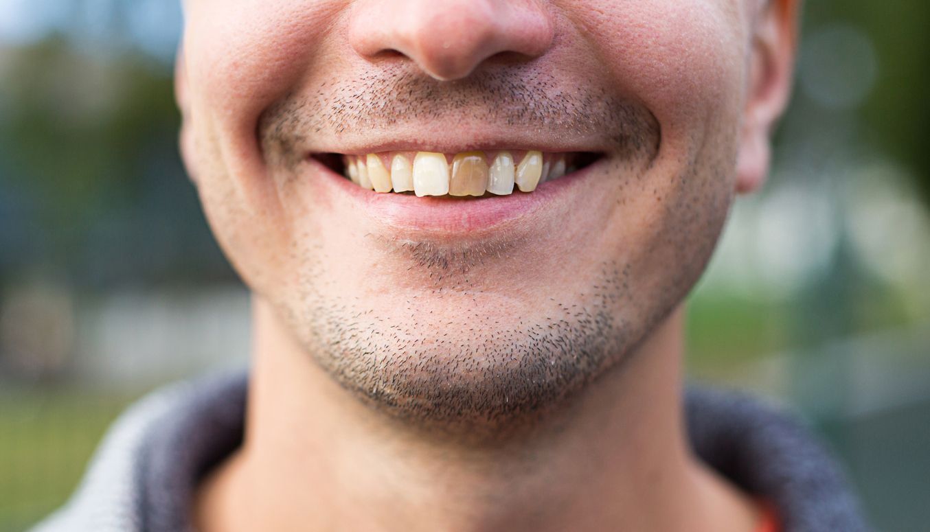A close up of a man 's mouth with a beard smiling.