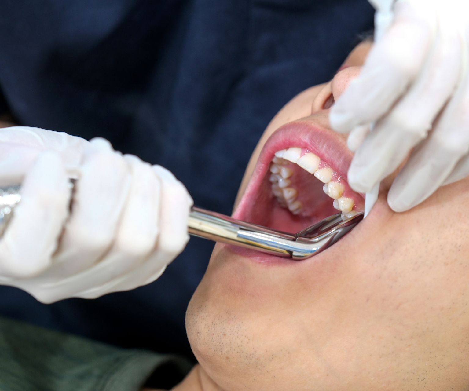 A dentist is working on a patient in a dental chair