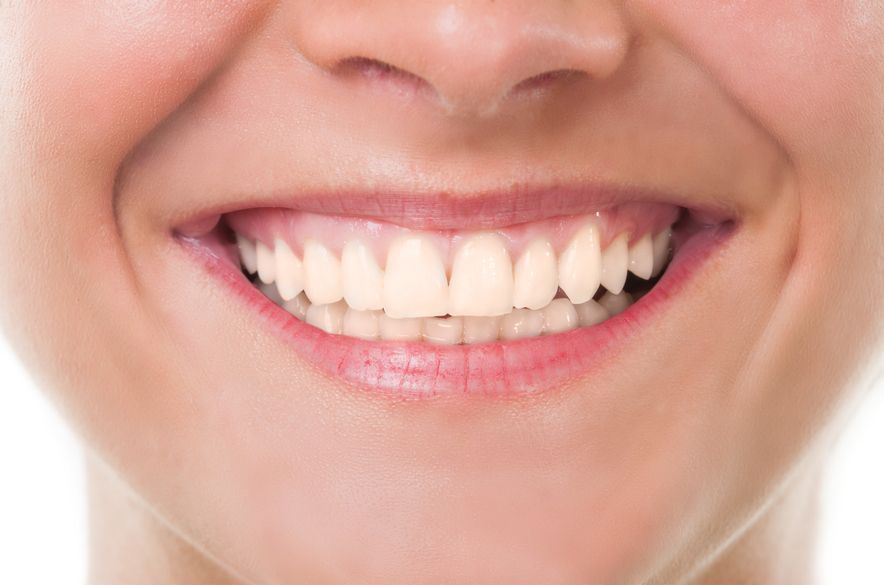A close up of a woman 's smile with white teeth.