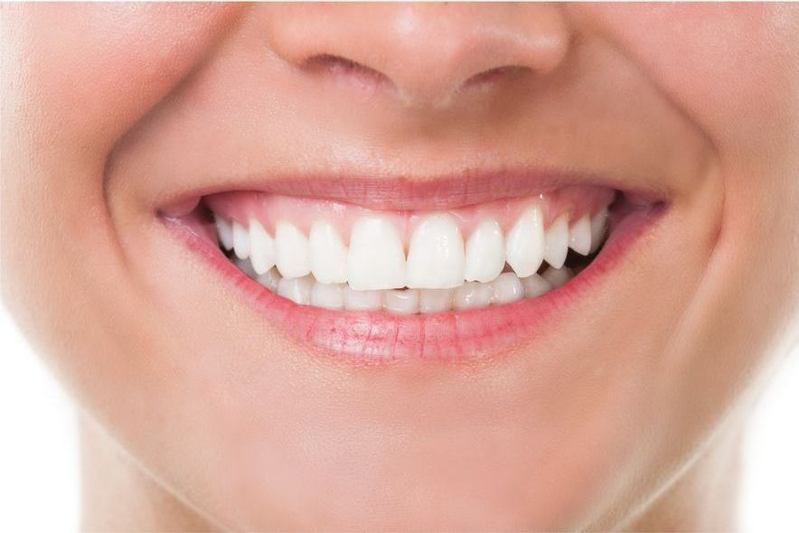 A close up of a woman 's smile with white teeth.