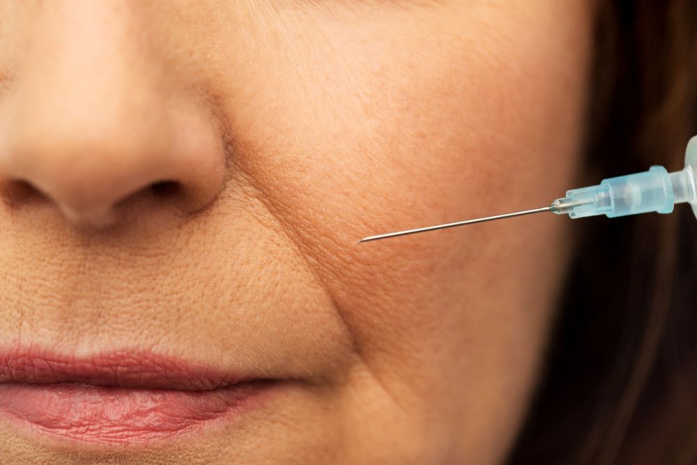 Close-up Of An Anti-wrinkle Injection Procedure