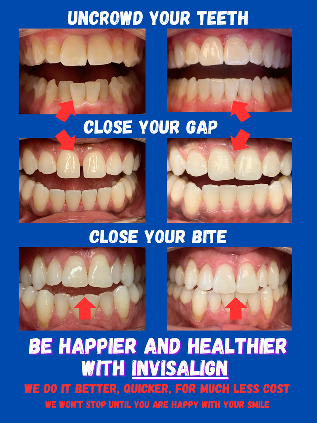 https://lirp.cdn-website.com/b856c3a6/dms3rep/multi/opt/Uncrowd+Your+Teeth-640w.png