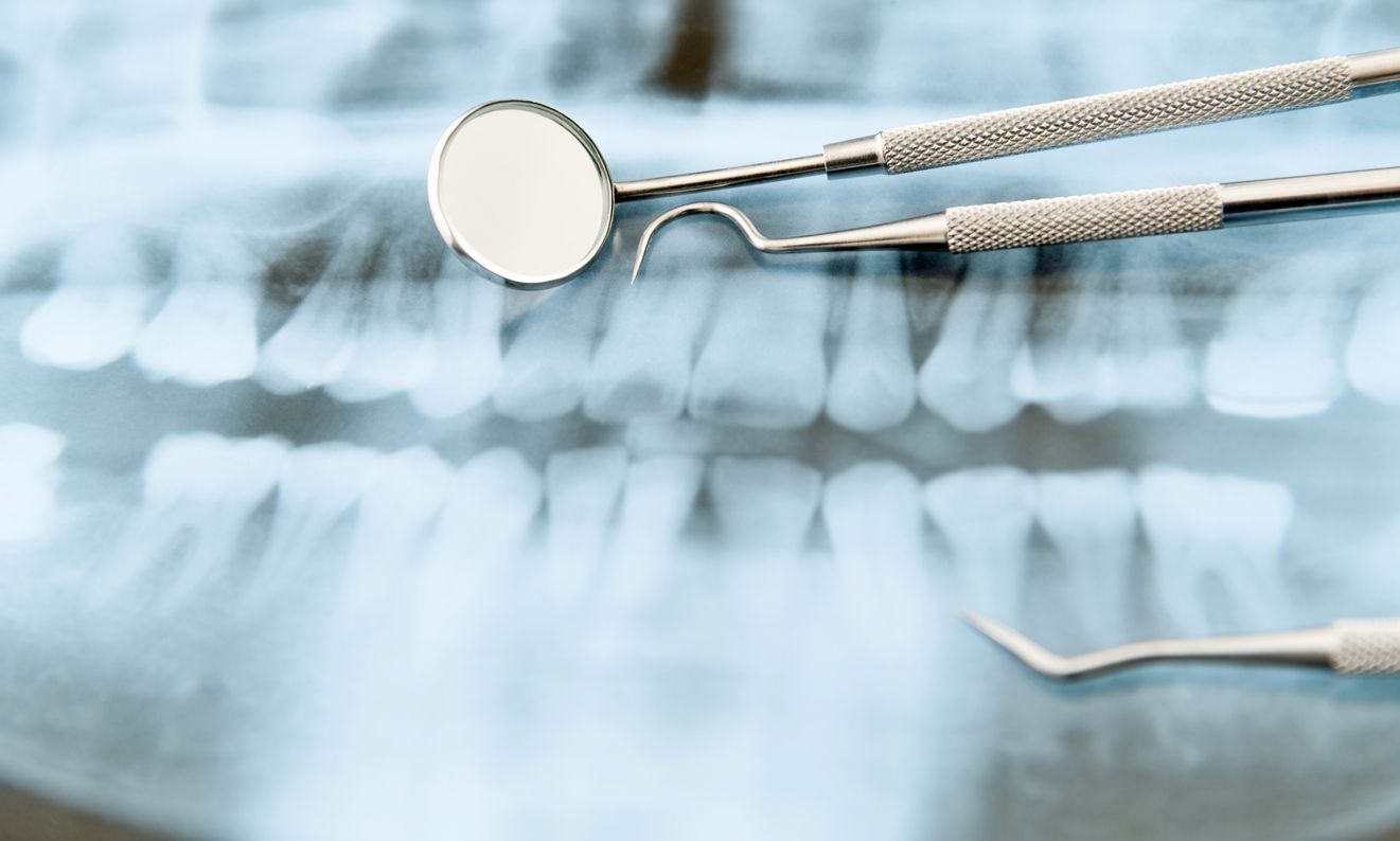 An x-ray of a person 's teeth with dental instruments.