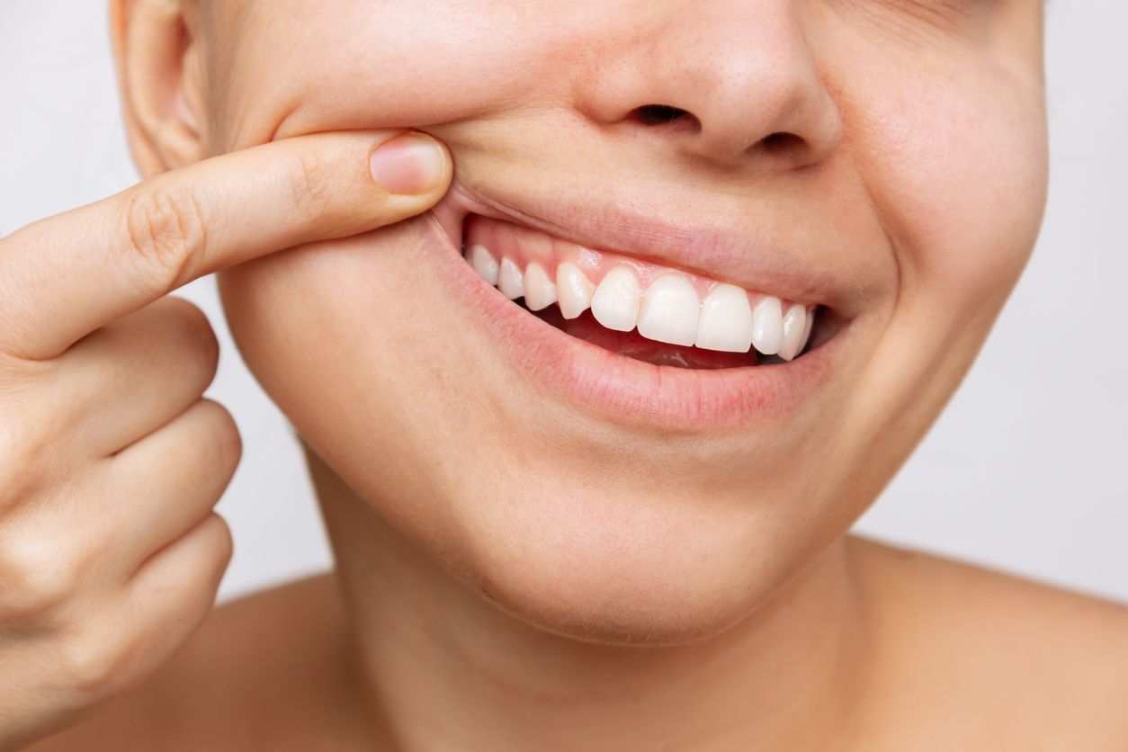Close-up of a person smiling, pointing to the side of their mouth, showing bright white teeth.