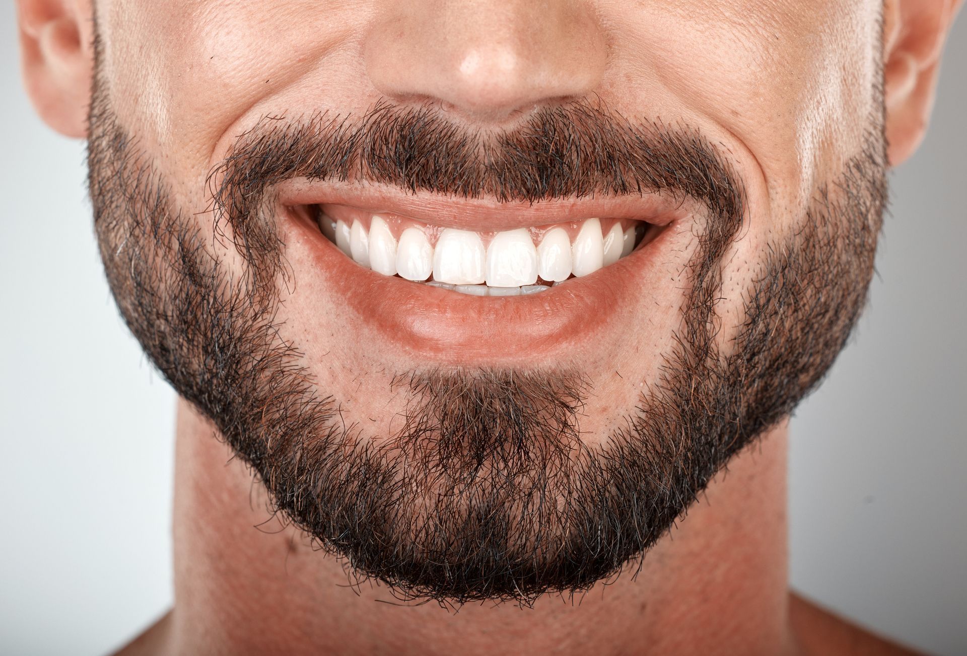 Close-up of a man with a full, dark beard and a bright, white smile, showing perfect teeth.