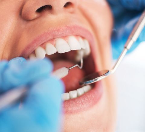 Oral Checkup — Fort Myers, FL — Children & Adult Dentistry