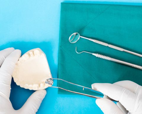 Implant and Prosthodontic Model — Fort Myers, FL — Children & Adult Dentistry
