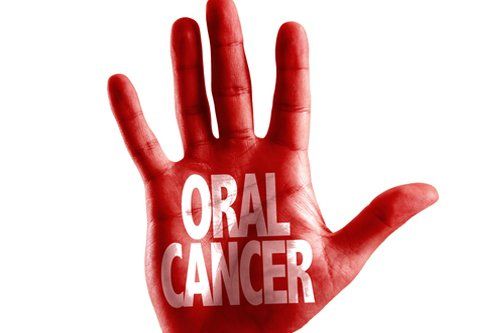 Oral Cancer — Fort Myers, FL — Children & Adult Dentistry