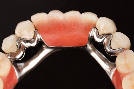 Dentures — Fort Myers, FL — Children & Adult Dentistry