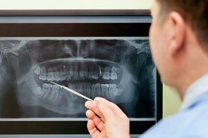 Dental X-Ray — Fort Myers, FL — Children & Adult Dentistry