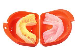 Mouth Guard — Fort Myers, FL — Children & Adult Dentistry