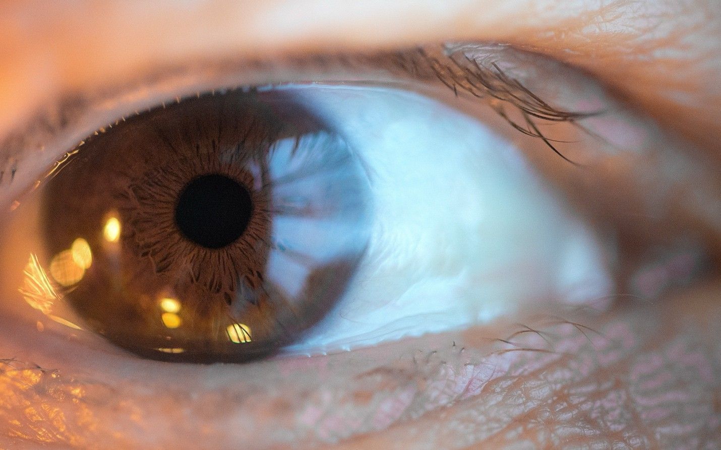 Eye Floaters and Flashes: When Are They a Warning Sign? | Ross Eye Institute
