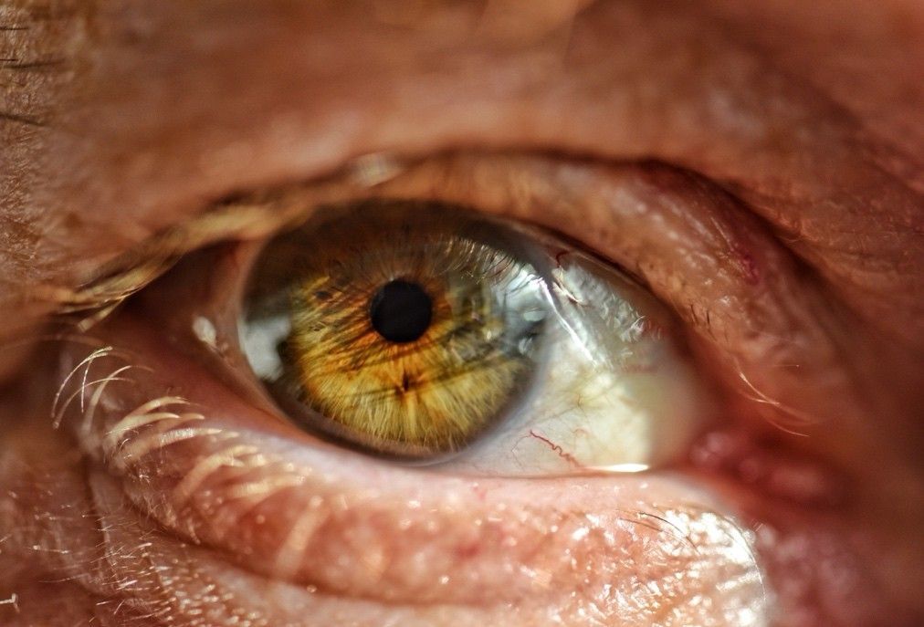How Systemic Diseases Show Up in the Eyes
