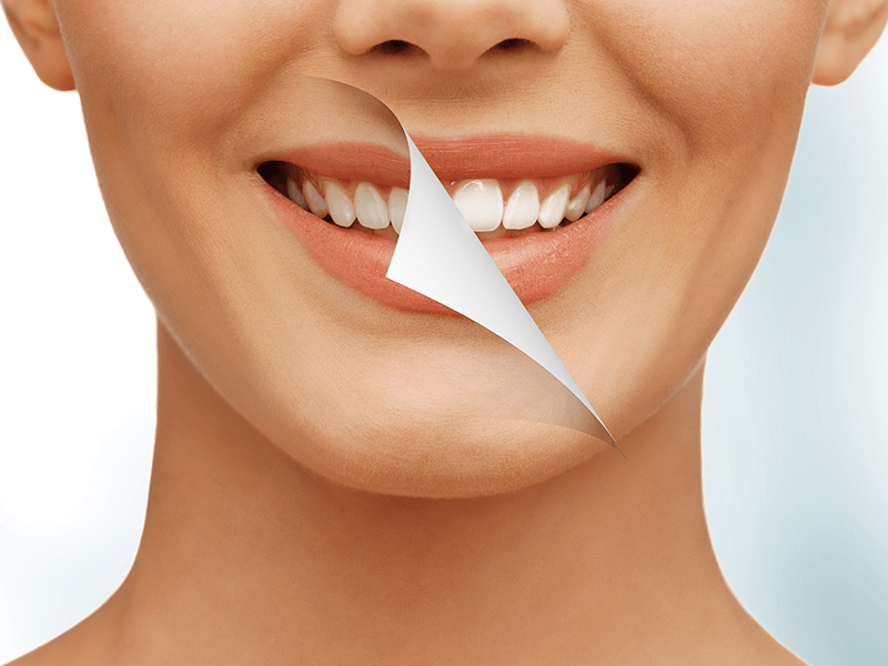 Why Choose an Endodontist?
