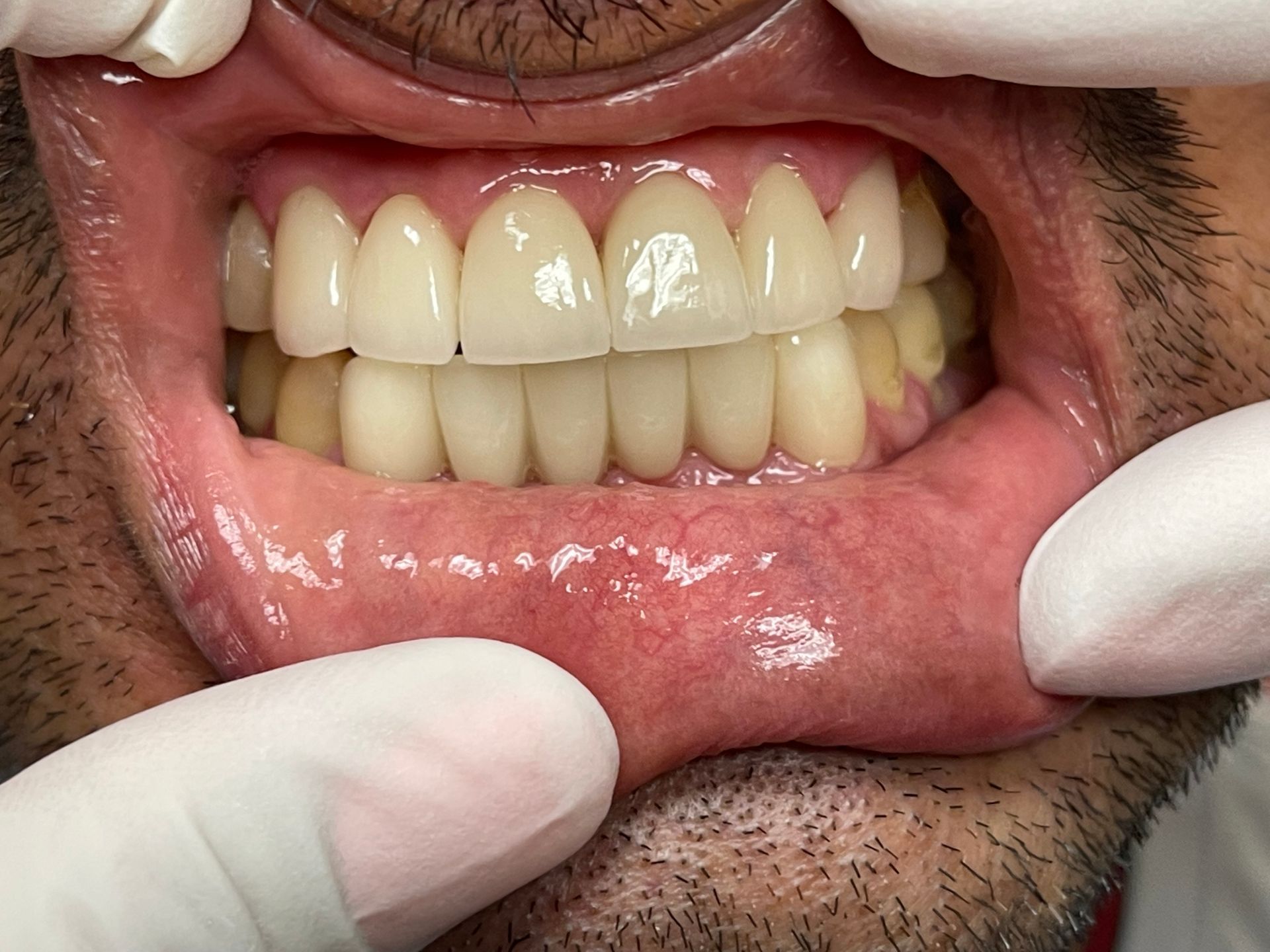 A close up of a man 's mouth with white teeth.