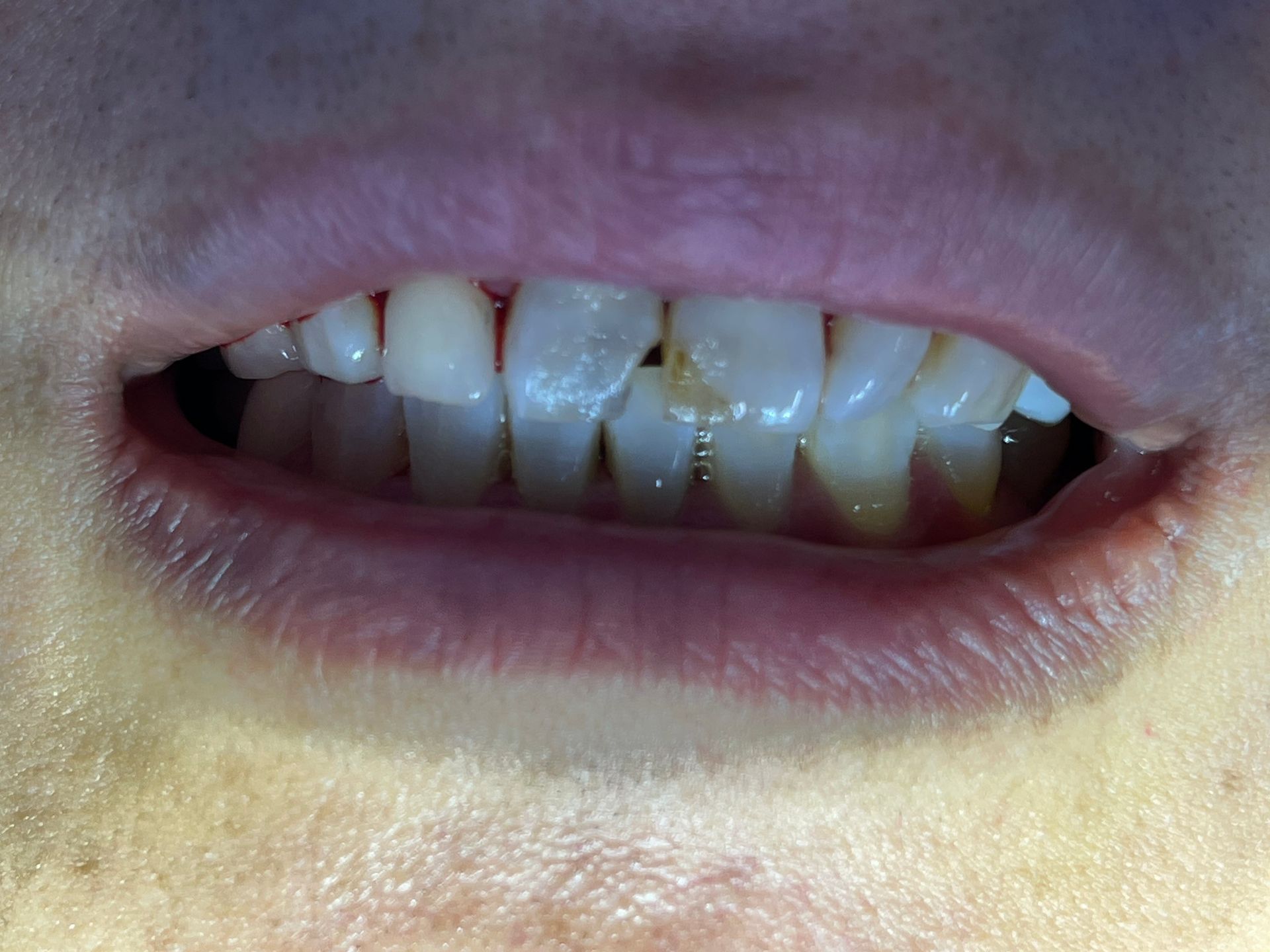 A close up of a person 's teeth and lips.