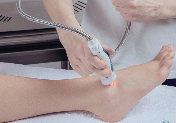 Trattamento laser su piede