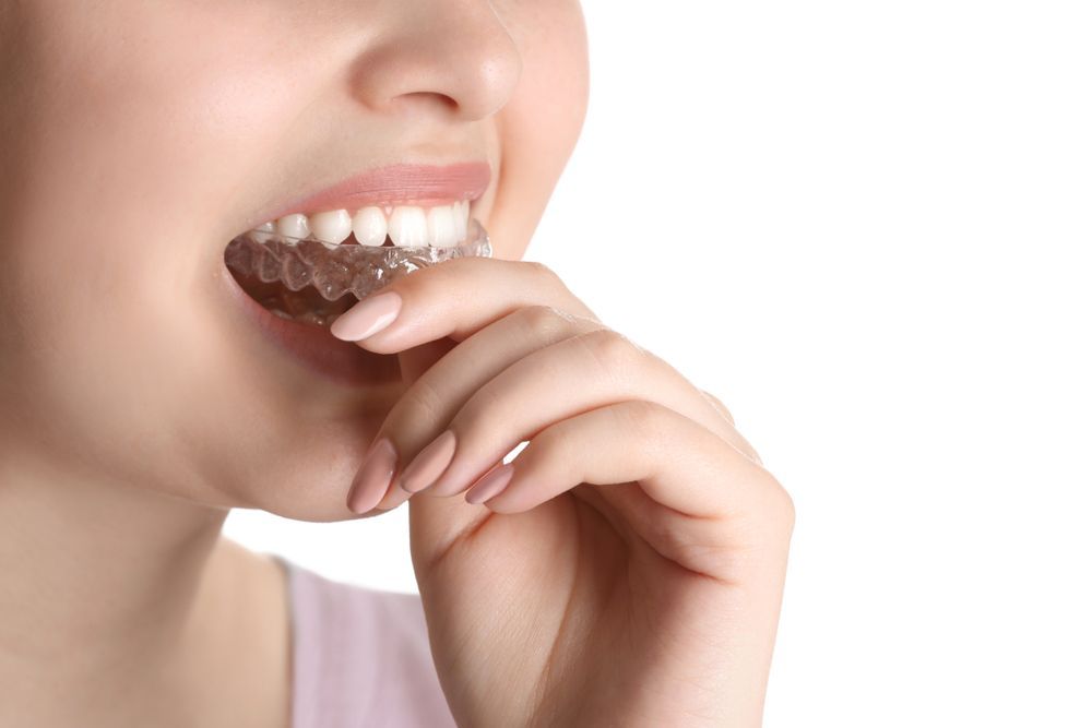 Person Applying a Clear Plastic Dental Aligner — Killara Dental in East Killara, NSW