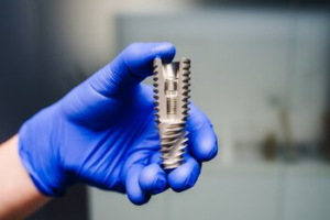 A Hand Wearing a Blue Nitrile Glove Holds a Titanium Dental Implant — Killara Dental in East Killara, NSW