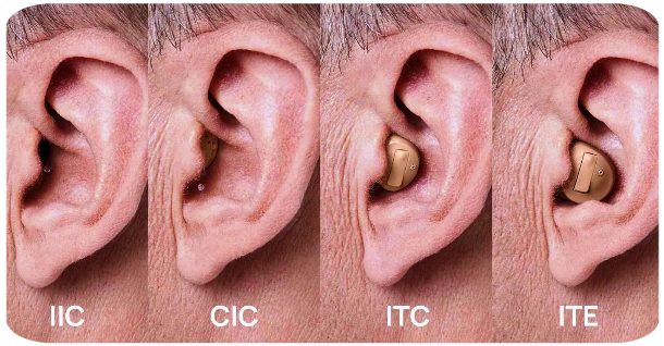 Apparecchi acustici endoauricolari
