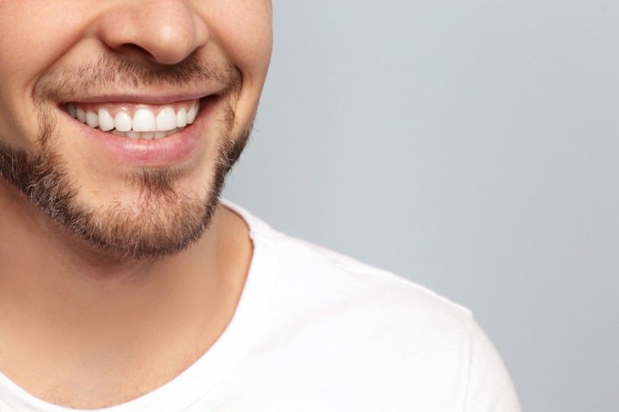 A Man With a Beard and White Teeth is Smiling — ProCare Dental Australia in East Maitland, NSW