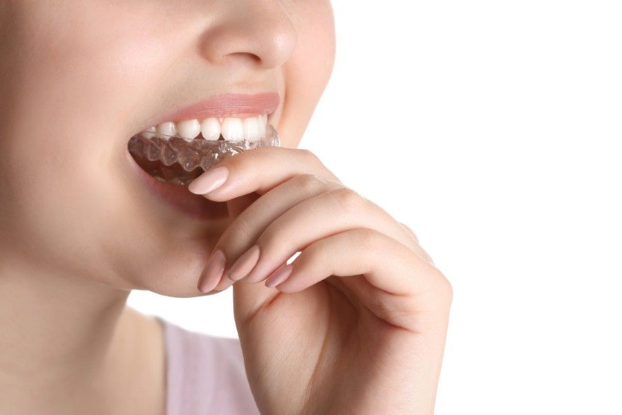 A Woman Mouth Guard With Her Teeth — ProCare Dental Australia in East Maitland, NSW