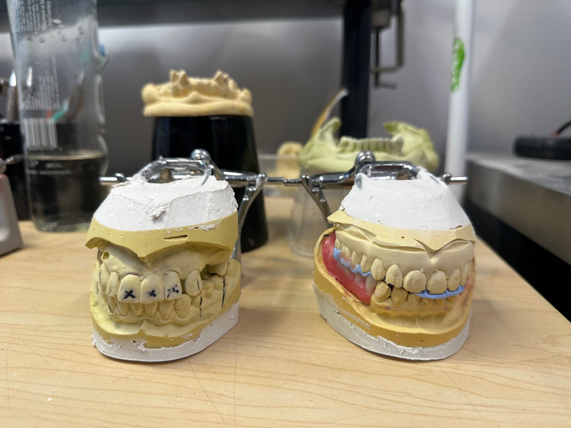 A Close Up of a Person Holding a Mouth Guard in Their Mouth — ProCare Dental Australia in East Maitland, NSW